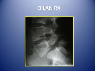 BILAN RX
 