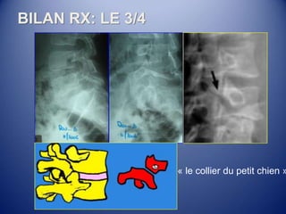 BILAN RX: LE 3/4
« le collier du petit chien »
 