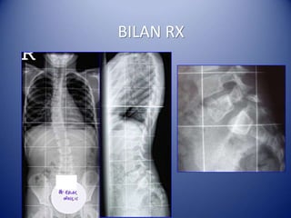 BILAN RX
 