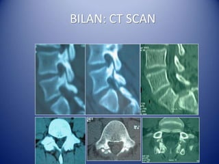 BILAN: CT SCAN
 
