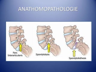 ANATHOMOPATHOLOGIE
 