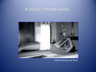  REDUCTION PAR HAMAC
Coll St Vincent de Paul
 