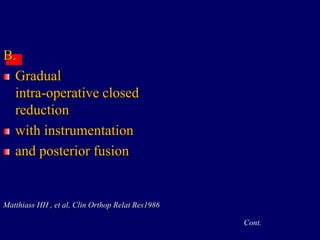 B.
Gradual
intra-operative closed
reduction
with instrumentation
and posterior fusion
Matthiass HH , et al, Clin Orthop Relat Res1986
Cont.
 