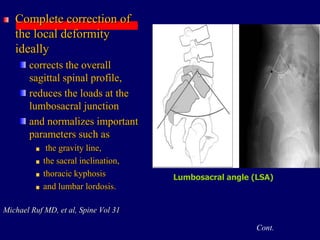 Complete correction of
the local deformity
ideally
corrects the overall
sagittal spinal profile,
reduces the loads at the
lumbosacral junction
and normalizes important
parameters such as
the gravity line,
the sacral inclination,
thoracic kyphosis
and lumbar lordosis.
Michael Ruf MD, et al, Spine Vol 31
Cont.
Lumbosacral angle (LSA)
 