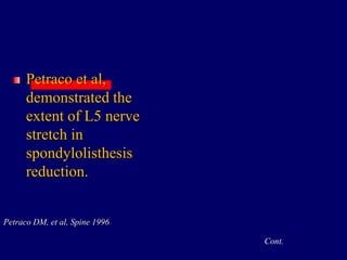 Petraco et al,
demonstrated the
extent of L5 nerve
stretch in
spondylolisthesis
reduction.
Petraco DM, et al, Spine 1996
Cont.
 