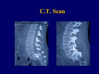C.T. Scan
 