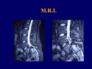 M.R.I.
 