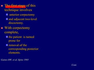 The first stage of this
technique involves
anterior corpectomy
and adjacent two-level
discectomy.
With corpectomy
complete,
the patient is turned
prone for
removal of the
corresponding posterior
elements.
Gaines RW, et al, Spine 1985
Cont.
 