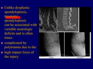 Unlike dysplastic
spondyloptosis,
traumatic
spondyloptosis
can be associated with
variable neurologic
deficits and is often
times
complicated by
polytrauma due to the
high impact force of
the injury.
 