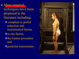 Many surgical
techniques have been
proposed in the
literature including:
complete or partial
reduction and
instrumented fusion,
in situ fusion,
the Gaines procedure
and
posterior osteotomies.
 