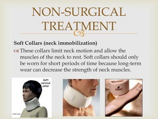 
Soft Collars (neck immobilization)
 These collars limit neck motion and allow the
muscles of the neck to rest. Soft collars should only
be worn for short periods of time because long-term
wear can decrease the strength of neck muscles.
NON-SURGICAL
TREATMENT
 
