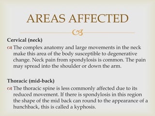 
Cervical (neck)
 The complex anatomy and large movements in the neck
make this area of the body susceptible to degenerative
change. Neck pain from spondylosis is common. The pain
may spread into the shoulder or down the arm.
Thoracic (mid-back)
 The thoracic spine is less commonly affected due to its
reduced movement. If there is spondylosis in this region
the shape of the mid back can round to the appearance of a
hunchback, this is called a kyphosis.
AREAS AFFECTED
 