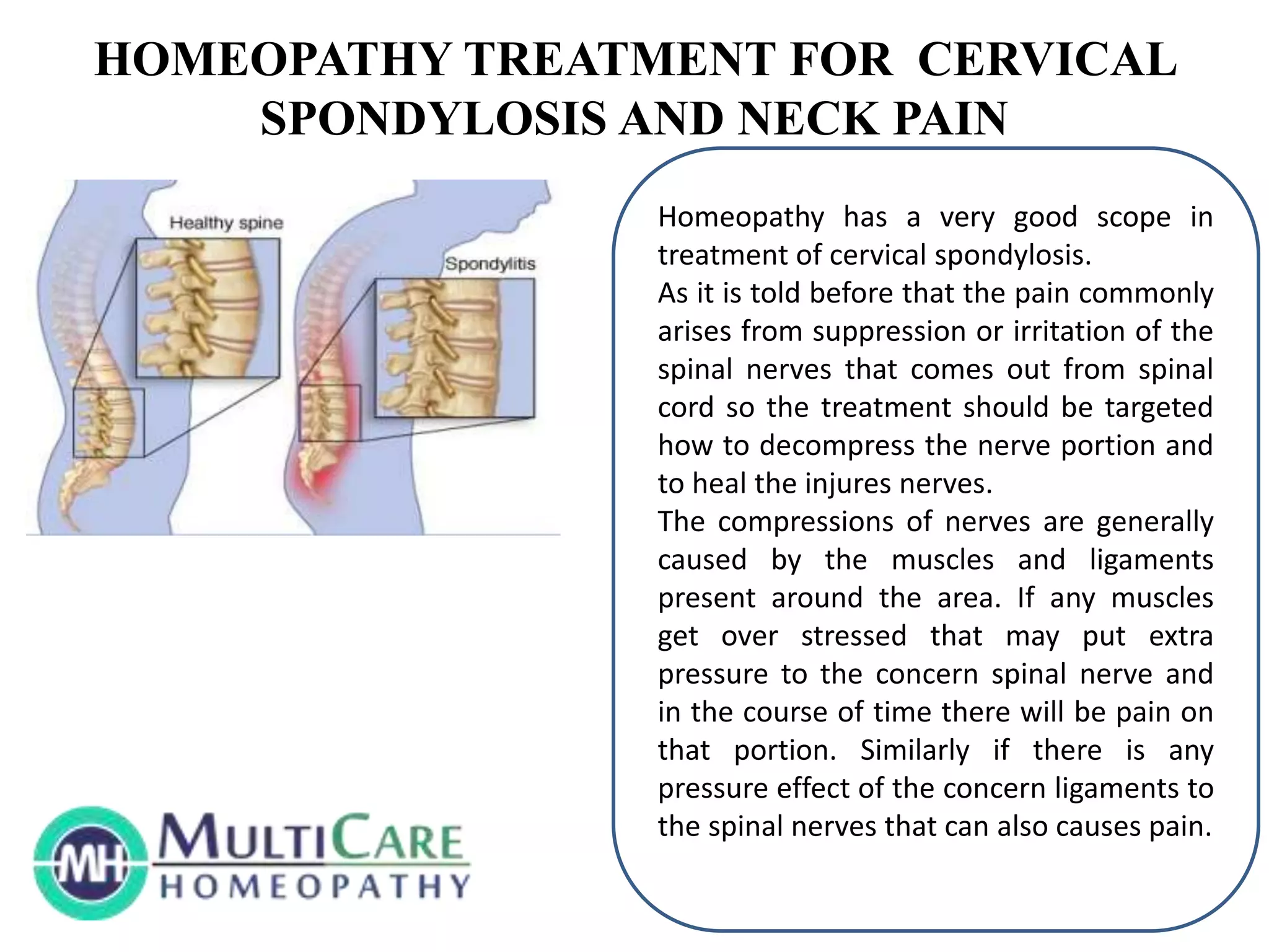 6 Best Homeopathic Medicines for Cervical spondylitis and Neck Pain. PPT