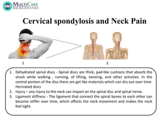 6 Best Homeopathic Medicines for Cervical spondylitis and Neck Pain. | PPTX