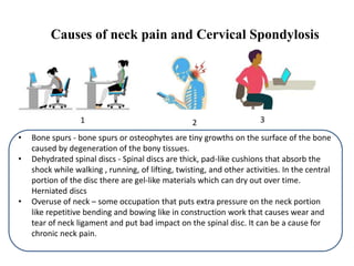 6 Best Homeopathic Medicines for Cervical spondylitis and Neck Pain. | PPTX