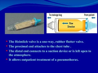 The Heimlich valve is a one-way, rubber flutter valve.  The proximal end attaches to the chest tube .  The distal end connects to a suction device or is left open to the atmosphere.  It allows outpatient treatment of a pneumothorax. 