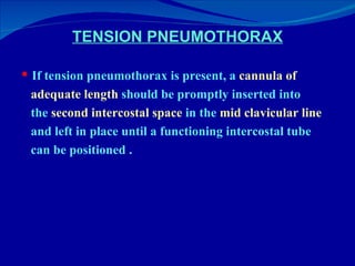 TENSION PNEUMOTHORAX If tension pneumothorax is present, a  cannula of adequate length  should be promptly inserted into the  second intercostal space  in the  mid clavicular line and left in place until a functioning intercostal tube can be positioned .  
