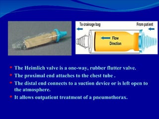 <ul><li>The Heimlich valve is a one-way, rubber flutter valve.  </li></ul><ul><li>The proximal end attaches to the chest t...