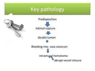 Key pathology
Predisposition
Intimal rupture
double lumen
Bleeding into vasa vasorum
intramural hematoma
abrupt vessel closure
 