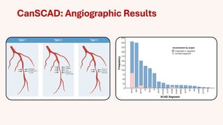 Spontaneous Coronary Artery Dissection (SCAD) | PDF