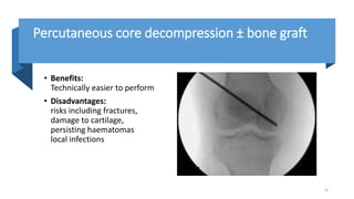 Spontaneous Osteonecrosis of the Knee.pptx