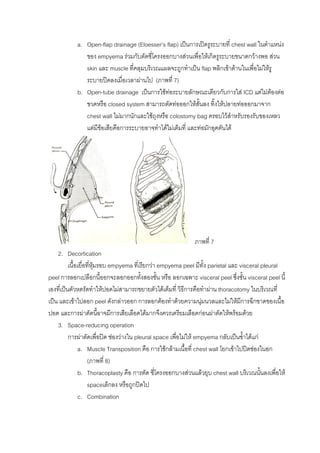 a. Open-flap drainage (Eloesser’s flap) เปนการเปดรูระบายที่ chest wall ในตําแหนง
              ของ empyema รวมกับตัดซีโครงออกบางสวนเพื่อใหเกิดรูระบายขนาดกวางพอ สวน
                                         ่
              skin และ muscle ที่คลุมบริเวณแผลจะถูกทําเปน flap พลิกเขาดานในเพื่อไมใหรู
              ระบายปดลงเมื่อเวลาผานไป (ภาพที่ 7)
           b. Open-tube drainage เปนการใชทอระบายลักษณะเดียวกับการใส ICD แตไมตองตอ
              ขวดหรือ closed system สามารถตัดทอออกใหสั้นลง ทิ้งใหปลายทอออกมาจาก
              chest wall ไมมากนักและใชถุงหรือ colostomy bag ครอบไวสําหรับรองรับของเหลว
              แตมีขอเสียคือการระบายอาจทําไดไมเต็มที่ และทอมักอุดตันได




                                                            ภาพที่ 7
    2. Decortication
          เนื้อเยื่อที่หมรอบ empyema ที่เรียกวา empyema peel มีทง parietal และ visceral pleural
                        ุ                                           ั้
peel การลอกเปลือกนี้ออกจะลอกออกทังสองชัน หรือ ลอกเฉพาะ visceral peel ซึ่งชั้น visceral peel นี้
                                          ้      ้
เองที่เปนตัวหดรัดทําใหปอดไมสามารถขยายตัวไดเต็มที่ วิธีการคือทําผาน thoracotomy ในบริเวณที่
เปน และเขาไปลอก peel ดังกลาวออก การลอกตองทําดวยความนุมนวลและไมใหมีการฉีกขาดของเนื้อ
                                                                   
ปอด และการผาตัดนี้อาจมีการเสียเลือดไดมากจึงควรเตรียมเลือดกอนผาตัดใหพรอมดวย
    3. Space-reducing operation
          การผาตัดเพื่อปด ชองวางใน pleural space เพื่อไมให empyema กลับเปนซ้ําไดแก
               a. Muscle Transposition คือ การใชกลามเนื้อที่ chest wall โยกเขาไปปดชองในอก
                     (ภาพที่ 8)
               b. Thoracoplasty คือ การตัด ซี่โครงออกบางสวนแลวยุบ chest wall บริเวณนันลงเพือให
                                                                                            ้  ่
                     spaceเล็กลง หรือถูกปดไป
               c. Combination
 