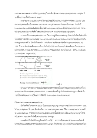 บางรายอาจตรวจพบอาการเขียว (cyanosis) ในรายทีมาดวยอาการของ cardiovascular collapse ก็
                                                    ่
จะมีสิ่งตรวจพบทั่วไปของภาวะ shock
         การถายภาพ x-ray ปอดจะชวยในการวินจฉัยไดโดยจะพบ การแยกจากกันของ parietal และ
                                                ิ
visceral pleura เห็นเปน visceral pleural line บางๆ หางจากขอบในของผนังทรวงอก รวมกับมี
hyperlucent area ของลมในชองอกซึ่งจะไมมี pulmonary markings ที่ขอบนอกภายในชองอก ขนาด
ของ pneumothorax จะเพิมขึ้นในขณะหายใจออกแรงๆ (maximal forced expiration)
                          ่
         การบอกปริมาณของ pneumothorax ก็สามารถดูไดจากภาพ x-ray ปอดเชนกัน โดยวัดคาเฉลี่ย
ของระยะหางระหวาง parietal และ visceral pleura (interpleural distance) แลวนําไปเปรียบเทียบกับ
nomogram (ภาพที่ 4) โดยถามีระยะหาง 1 เซนติเมตร จะเทียบเทากับปริมาณ pneumothorax 10-
15% ถาระยะหาง 2 เซนติเมตร จะเทียบเทากับ 20-25% และถามากกวา 4 เซนติเมตร ก็จะประมาณ
มากกวา 40% การแบงขนาดของ pneumothorax ก็จะแบงเปน 3 ระดับคือ small (<20%), moderate
(20-40%) และ large (>40%)




                                                     ภาพที่ 4
        CT scan จะชวยบอกรายละเอียดของพยาธิสภาพของเนือปอด โดยเฉพาะถุงลมโปงพองที่อาจ
                                                          ้
ตรวจพบและเปนสาเหตุของ pneumohorax การตรวจพิเศษอื่นๆไดแก bronchoscopy จะเลือกทําใน
รายที่ปอดไมสามารถขยายไดหลังจากใส ICD (intercostals closed drainage)

Primary spontaneous pneumothorax
         เปนโรคทีพบในกลุมอายุ 20-30 ป (disease of young adult) สาเหตุเกิดจากการแตกของ bleb
                   ่
ใต visceral pleura ซึ่ง bleb ดังกลาวเกิดจากการแตกของถุงลมปอดทําใหอากาศแทรกออกมาสะสมที่
ใต visceral pleura การตรวจทางพยาธิพบวา bleb เหลานี้ไมมีเยื่อบุผิว หรือ epitherial lining ซึ่งชวย
สนับสนุนวา bleb เหลานี้เกิดขึ้นจาก acquired etiology
         สาเหตุที่แทจริงยังไมปรากฏชัด แตก็อธิบายไดวา จากการมีความแตกตางของความดันลบที่
บริเวณสวนบนและสวนลางภายในชองอกในทา upright ทําให ถุงลม (alveoli)ในสวนยอดของปอด โปง
 