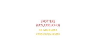 SPOTTERS
(ECG,CXR,ECHO)
DR. MAHENDRA
CARDIOLOGY,JIPMER
 