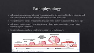Sporadic colon cancer