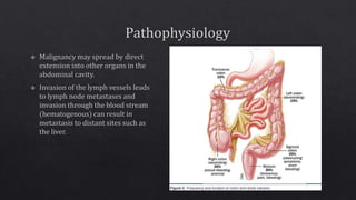 Sporadic colon cancer