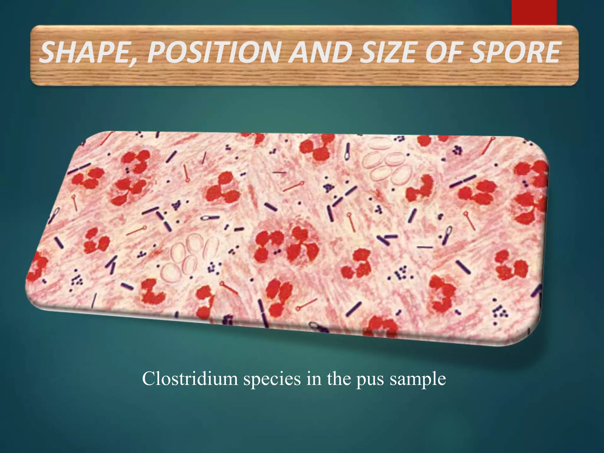 SHAPE, POSITION AND SIZE OF SPORE
Clostridium species in the pus sample
 