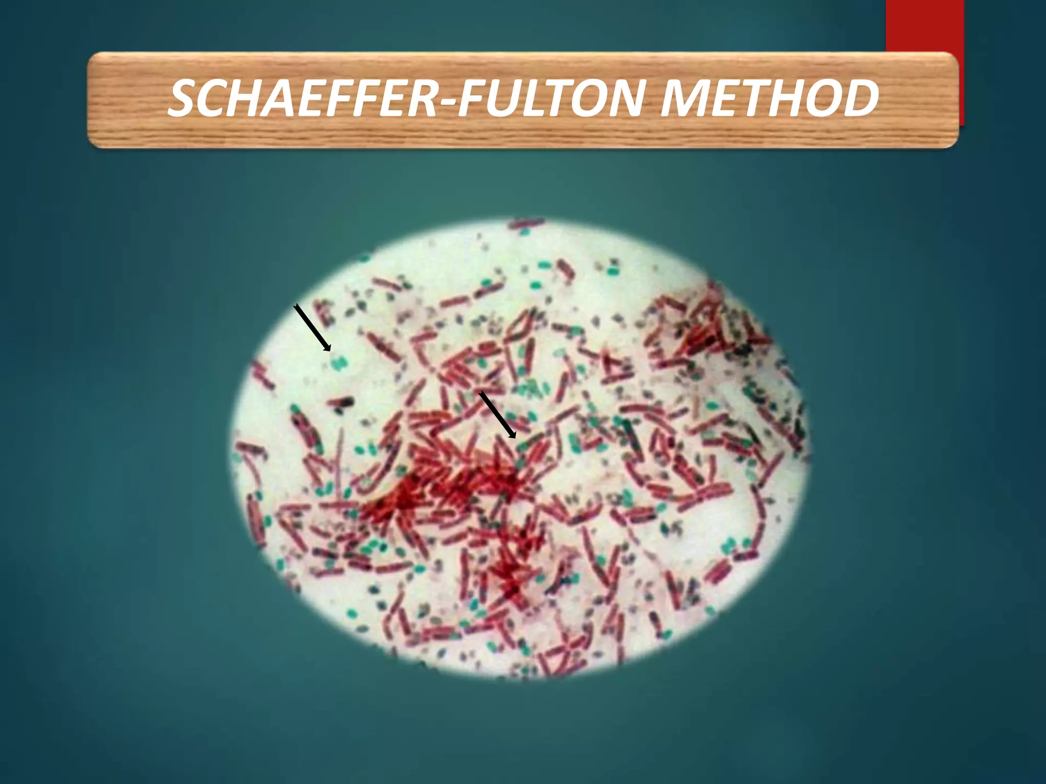 SCHAEFFER-FULTON METHOD
 