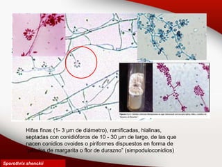 Sporothrix shenckii
Hifas finas (1- 3 µm de diámetro), ramificadas, hialinas,
septadas con conidióforos de 10 - 30 µm de largo, de las que
nacen conidios ovoides o piriformes dispuestos en forma de
“pétalos de margarita o flor de durazno” (simpoduloconidios)
 