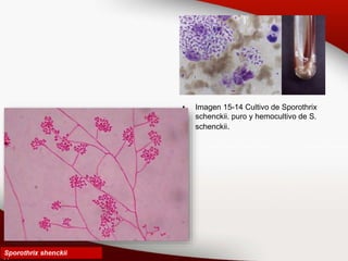 • Imagen 15-14 Cultivo de Sporothrix
schenckii. puro y hemocultivo de S.
schenckii.
 