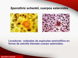Sporothrix schenkii, cuerpos esteroides
Levaduras rodeadas de espículas eosinofílica en
forma de estrella llamada cuerpo asteroides.
Sporothrix shenckii
 