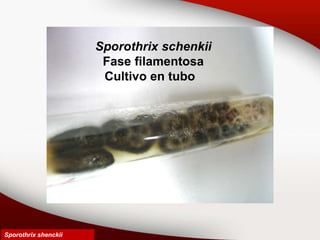 Sporothrix schenkii
Fase filamentosa
Cultivo en tubo
Sporothrix shenckii
 