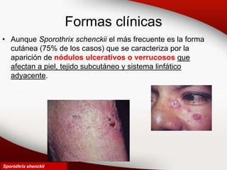 Formas clínicas
• Aunque Sporothrix schenckii el más frecuente es la forma
cutánea (75% de los casos) que se caracteriza por la
aparición de nódulos ulcerativos o verrucosos que
afectan a piel, tejido subcutáneo y sistema linfático
adyacente.
Sporothrix shenckii
 