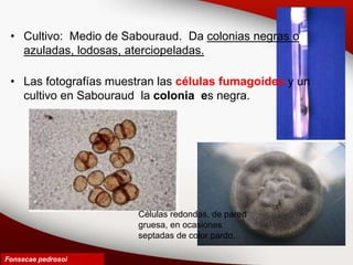 • Cultivo: Medio de Sabouraud. Da colonias negras o
azuladas, lodosas, aterciopeladas.
• Las fotografías muestran las células fumagoides y un
cultivo en Sabouraud la colonia es negra.
Fonsecae pedrosoi
Células redondas, de pared
gruesa, en ocasiones
septadas de color pardo.
 