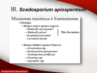 III. Scedosporium apiospermum
Scedosporium apiospermum
 