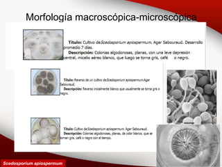 Morfología macroscópica-microscópica
Scedosporium apiospermum
 