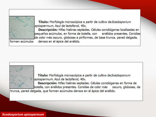 Scedosporium apiospermum
 