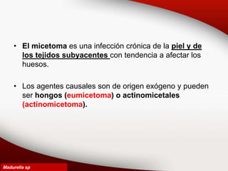 • El micetoma es una infección crónica de la piel y de
los tejidos subyacentes con tendencia a afectar los
huesos.
• Los agentes causales son de origen exógeno y pueden
ser hongos (eumicetoma) o actinomicetales
(actinomicetoma).
Madurella sp
 