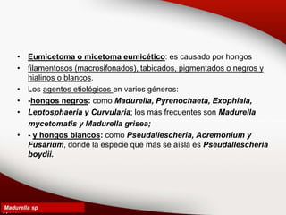 • Eumicetoma o micetoma eumicético: es causado por hongos
• filamentosos (macrosifonados), tabicados, pigmentados o negros y
hialinos o blancos.
• Los agentes etiológicos en varios géneros:
• -hongos negros: como Madurella, Pyrenochaeta, Exophiala,
• Leptosphaeria y Curvularia; los más frecuentes son Madurella
mycetomatis y Madurella grisea;
• - y hongos blancos: como Pseudallescheria, Acremonium y
Fusarium, donde la especie que más se aísla es Pseudallescheria
boydii.
 