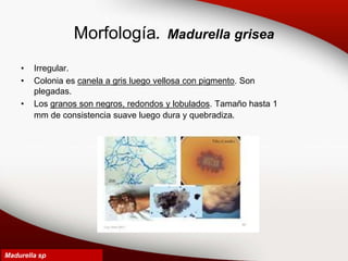 Morfología. Madurella grisea
• Irregular.
• Colonia es canela a gris luego vellosa con pigmento. Son
plegadas.
• Los granos son negros, redondos y lobulados. Tamaño hasta 1
mm de consistencia suave luego dura y quebradiza.
Madurella sp
 