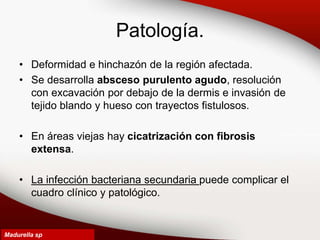 Patología.
• Deformidad e hinchazón de la región afectada.
• Se desarrolla absceso purulento agudo, resolución
con excavación por debajo de la dermis e invasión de
tejido blando y hueso con trayectos fistulosos.
• En áreas viejas hay cicatrización con fibrosis
extensa.
• La infección bacteriana secundaria puede complicar el
cuadro clínico y patológico.
Madurella sp
 