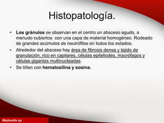 Histopatología.
• Los gránulos se observan en el centro un absceso agudo, a
menudo cubiertos con una capa de material homogéneo. Rodeado
de grandes acúmulos de neutrófilos en todos los estados.
• Alrededor del absceso hay área de fibrosis densa y tejido de
granulación, rico en capilares, células epiteliodes, macrófagos y
células gigantes multinucleadas.
• Se tiñen con hematoxilina y eosina.
Madurella sp
 