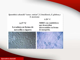 Sporothrix shenckii
 