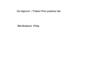 Os trigonum  / Fraktur Proc posterior tali Bild Bradonic  Philip 