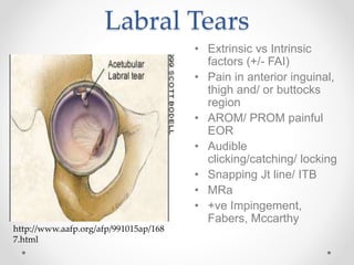Labrum Click Sporting Hip and Groin | PPTX