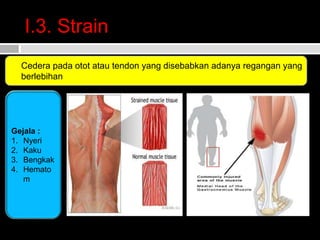 SPORT INJURI ( Dr Sonny Gosal M KES AIFO).ppt